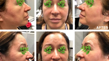 Skin Awakening Cannabis Renewal Facial